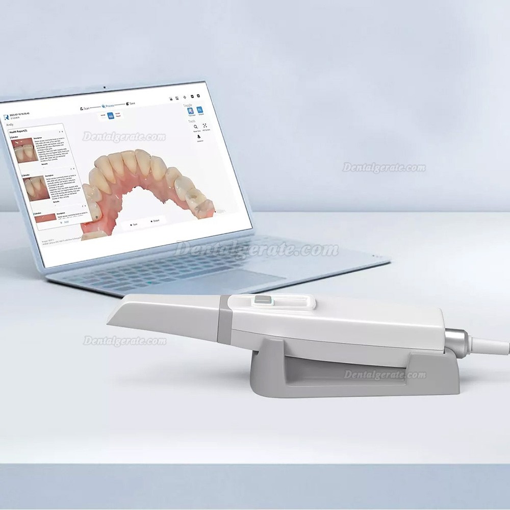 YP-11 Echtfarbiger Intraoralscanner Zahnarzt /3D Mundscanner mit Software